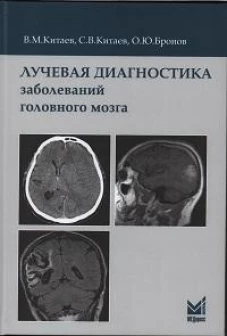 Лучевая диагностика заболеваний головного мозга