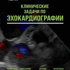 Клинические задачи по эхокардиографии